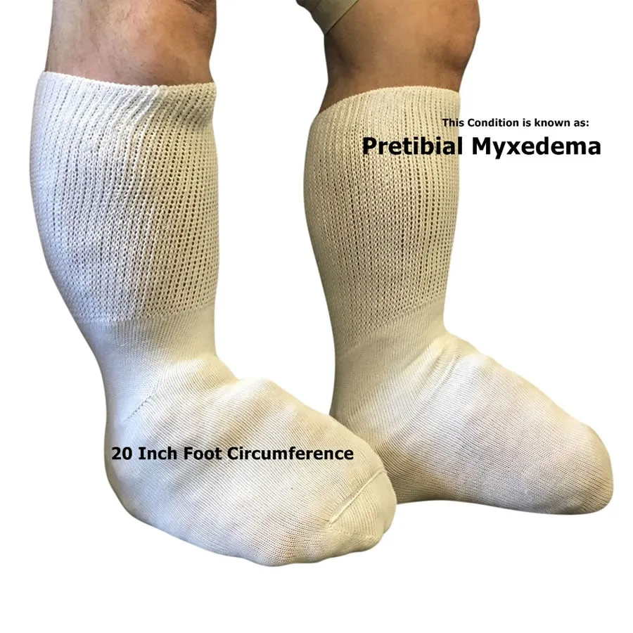 Beyond Extra Wide Bariatric Socks